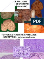 Neoplazia 1