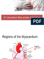 ST Elevation Miocardial Infarction