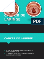 Cancer de Laringe