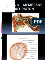 Causes and Treatment of Tympanic Membrane Perforation