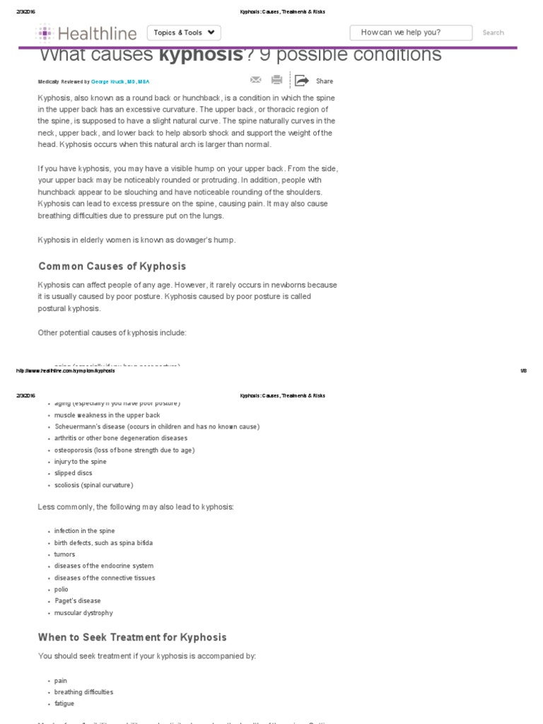 Kyphosis - Causes, Treatments & Risks | PDF | Poliomyelitis | Diseases ...