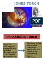 Infecciones Torch