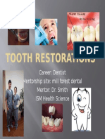 Tooth Restorations