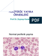 Periferik Yayma