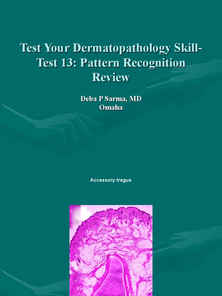 Test Your Dermatopathology SkillTest 13 Pattern Recognition Review PDF