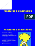 04- Fracturas de Acetabulo
