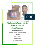 Fisiopatología de La Tiroiditis de Hashimoto