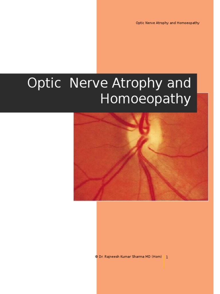 Optic Nerve Atrophy and Homoeopathy Retina Peripheral Neuropathy