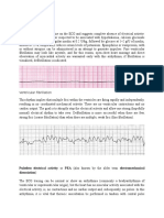 Asystole: Ventricular Fibrillation