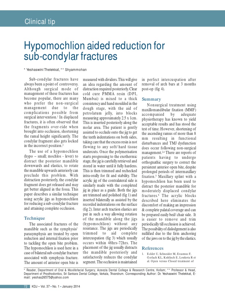 Hypomochlion Aided Reduction For Sub-Condylar Fractures | PDF ...