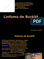 Linfoma de Burkitt