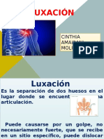 Luxación