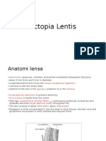 Ectopia Lentis