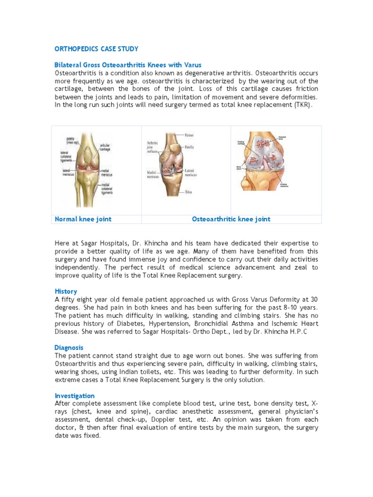 Total Knee Replacement Case Study | PDF | Osteoarthritis | Orthopedic ...