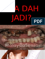 Apa Dah Jadi