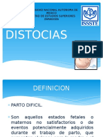 Distocias