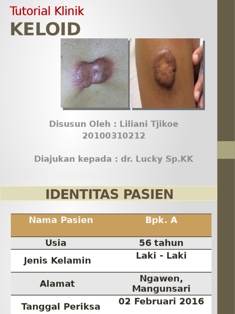 Tutorial Klinik KELOID | PDF | Sains & Matematika