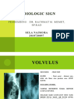 Radiologic Sign Sela
