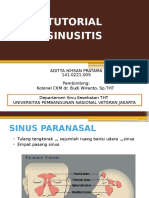 Sinusitis Titu
