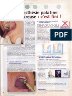 2007 Villette L'anesthésie Palatine Douloureuse C'est finiL'Anesthésie Palatine Douloureuse C'est Fini Le Fil Dentaire