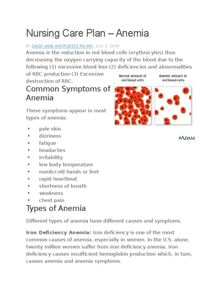 Nursing Care Plan PDF Anemia Vitamin B12