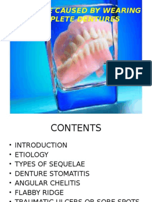 Sequelae By Complete Denture Original 1 Dentures Candidiasis