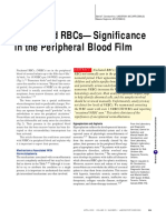 Nucleated RBCs—Significance