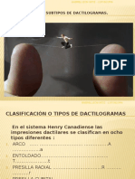 Myslide.es Tipos de Dactilogramas 1