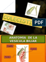 Colecistitis