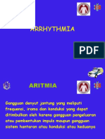 Arithmia Oke