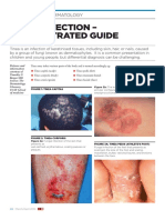 BJFM March 14 p22-23 Tinea Infection