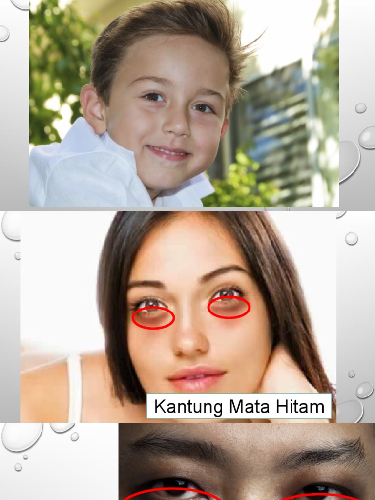 Tidur Yang Mencukupi – Kesannya Pada Penampilan Kulit