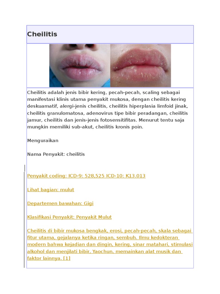Cheilitis | PDF