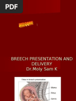 Download Breech Presentation Dr Moly Sam K on 17-04-2010 Final by DrKTPaulachan Senior Clinical Psychologist IMHANS Calicut Kerala Indian SN30060269 doc pdf