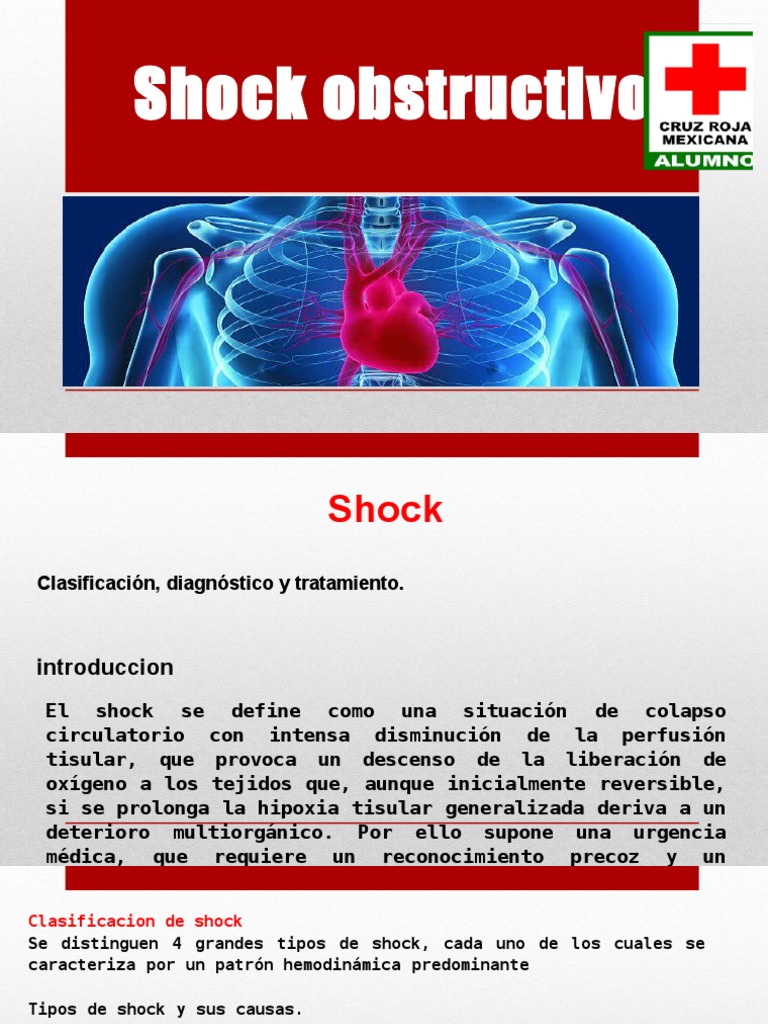 Shock Obstructivo Shock (Circulatory) Heart
