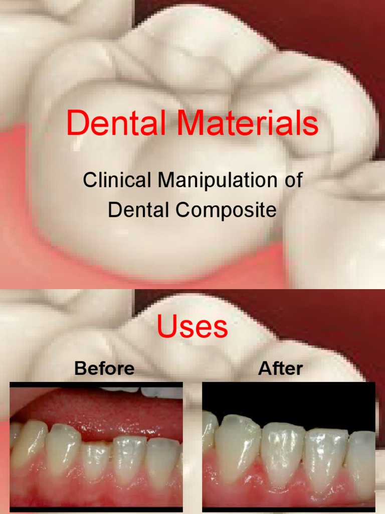 Clinical Steps in Dental Composite Repair | PDF