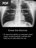 Chest X-Ray Interpretation Guide | PDF | Lung | Thorax