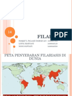 Filariasis