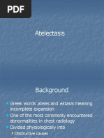 Atelectasis