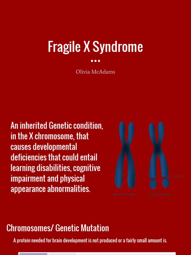 Fragile X Syndrome | PDF | Medicine | Clinical Psychology