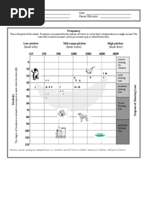 audiogram