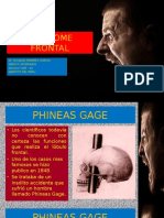 Sindrome Frontal