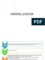 Herpes Zoster