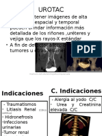 TC Urotac: Detección de tumores y lesiones renales