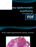 Solitary Epidermolytic Acanthoma