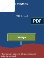 Kelainan Pigmen(Vitiligo)
