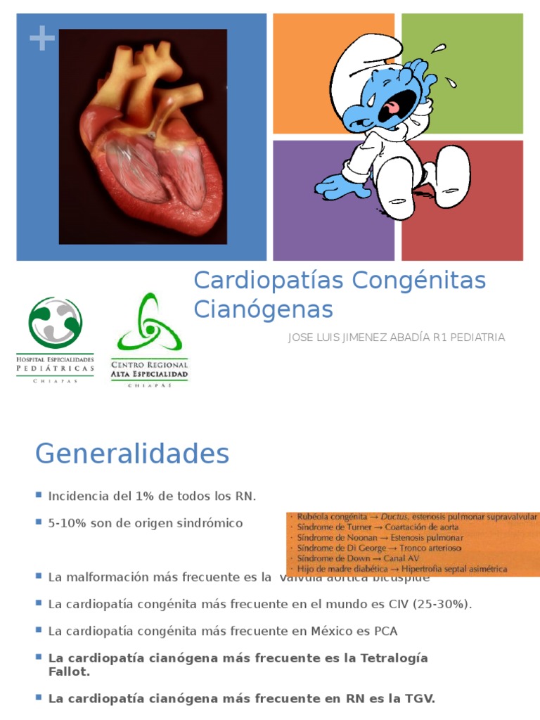 Cardiopatia Congenita Cianogena Mas Frecuente