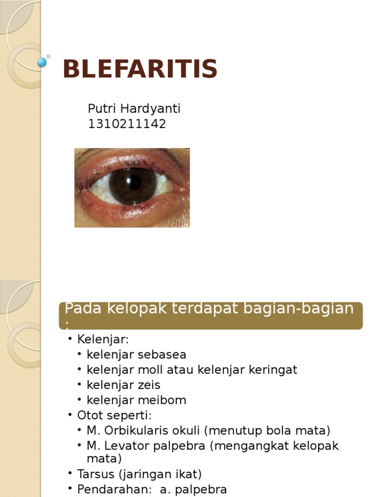 Patofisiologi dan Pengobatan Blefaritis | PDF