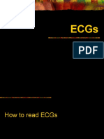 Pediatric Ecgs