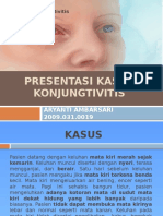 Presus Konjungtivitis